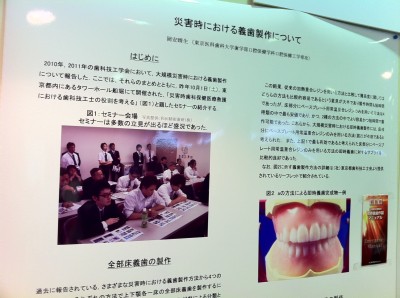 緊急時入れ歯